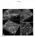 Fig. 16 - Collagen-based matrices with stem cells