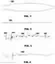 Fig. 02 - Method for Extending and Improving the Functionality of a Hard Surface