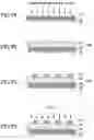 Fig. 08 - PATTERNED MEDIUM AND METHOD OF PRODUCING PATTERNED MEDIUM