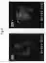 Fig. 07 - Primitive organ-like structure comprising keratinocytes and hair papilla cells
