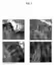 Fig. 02 - Method for detecting and treating skin disorders
