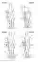 Fig. 04 - Abdominal muscle training device