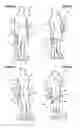 Fig. 05 - Abdominal muscle training device