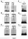 Fig. 17 - REGULATORY ELEMENTS THAT MEDIATE RETINAL CELL-SPECIFIC GENE EXPRESSION