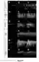 Fig. 19 - REGULATORY ELEMENTS THAT MEDIATE RETINAL CELL-SPECIFIC GENE EXPRESSION