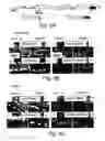 Fig. 12 - Antisense oligonucleotide against human acetylcholinesterase (AChE) and uses thereof