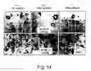 Fig. 18 - Antisense oligonucleotide against human acetylcholinesterase (AChE) and uses thereof