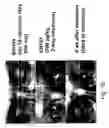 Fig. 22 - Antisense oligonucleotide against human acetylcholinesterase (AChE) and uses thereof