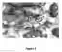 Fig. 02 - Compounds for lysosomal modulation and methods of use