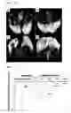 Fig. 06 - Pharmaceutical composition for treating or preventing degenerative and inflammatory diseases