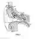 Fig. 02 - FLUID CUSHION SUPPORT FOR IMPLANTABLE DEVICE