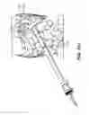 Fig. 35 - DEVICES, SYSTEM AND METHODS FOR MINIMALLY INVASIVE ABDOMINAL SURGICAL PROCEDURES