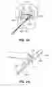 Fig. 37 - DEVICES, SYSTEM AND METHODS FOR MINIMALLY INVASIVE ABDOMINAL SURGICAL PROCEDURES