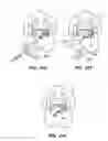 Fig. 41 - DEVICES, SYSTEM AND METHODS FOR MINIMALLY INVASIVE ABDOMINAL SURGICAL PROCEDURES