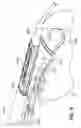 Fig. 04 - Devices, tools and methods for performing minimally invasive abdominal surgical procedures