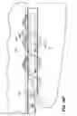 Fig. 22 - Devices, tools and methods for performing minimally invasive abdominal surgical procedures
