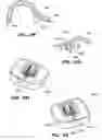 Fig. 45 - Devices, tools and methods for performing minimally invasive abdominal surgical procedures