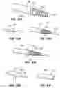 Fig. 64 - Devices, tools and methods for performing minimally invasive abdominal surgical procedures