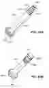 Fig. 65 - Devices, tools and methods for performing minimally invasive abdominal surgical procedures