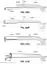 Fig. 74 - Devices, tools and methods for performing minimally invasive abdominal surgical procedures