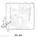 Fig. 77 - Devices, tools and methods for performing minimally invasive abdominal surgical procedures