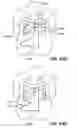 Fig. 79 - Devices, tools and methods for performing minimally invasive abdominal surgical procedures