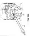 Fig. 82 - Devices, tools and methods for performing minimally invasive abdominal surgical procedures