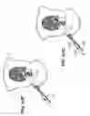 Fig. 87 - Devices, tools and methods for performing minimally invasive abdominal surgical procedures