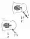 Fig. 89 - Devices, tools and methods for performing minimally invasive abdominal surgical procedures