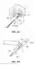 Fig. 35 - DEVICES, SYSTEM AND METHODS FOR MINIMALLY INVASIVE ABDOMINAL SURGICAL PROCEDURES