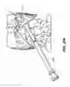 Fig. 37 - DEVICES, SYSTEM AND METHODS FOR MINIMALLY INVASIVE ABDOMINAL SURGICAL PROCEDURES