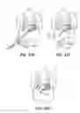 Fig. 41 - DEVICES, SYSTEM AND METHODS FOR MINIMALLY INVASIVE ABDOMINAL SURGICAL PROCEDURES