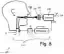 Fig. 06 - Optical Triggering System For Stroboscopy, And A Stroboscopic System