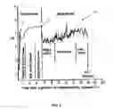 Fig. 08 - Method of determining the slow wave of a gastrointestinal tract