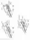 Fig. 15 - MRI Biopsy Apparatus Incorporating a Sleeve and Multi-Function Obturator