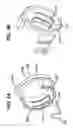 Fig. 06 - Lancing devices and methods