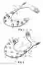 Fig. 02 - INFUSION SITE RETAINER