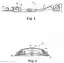 Fig. 04 - INFUSION SITE RETAINER
