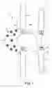 Fig. 06 - INFUSION SITE RETAINER
