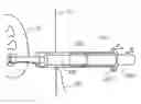 Fig. 01 - Hemostatic devices and methods for use thereof