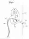Fig. 02 - Hemostatic devices and methods for use thereof