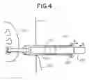 Fig. 05 - Hemostatic devices and methods for use thereof