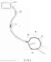 Fig. 02 - ARRANGEMENT FOR USE WITH A BALLOON ABLATION CATHETER