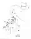 Fig. 02 - Apparatus for arthroscopic assisted arthroplasty of the hip joint