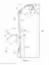 Fig. 04 - Apparatus for arthroscopic assisted arthroplasty of the hip joint