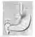Fig. 01 - Devices and methods for treatment of gastrointestinal disorders