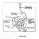Fig. 02 - Devices and methods for treatment of gastrointestinal disorders