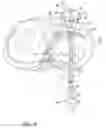 Fig. 09 - Method for repairing a meniscal tear