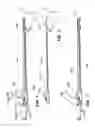 Fig. 02 - Devices, tools and methods for performing minimally invasive abdominal surgical procedures