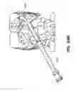 Fig. 85 - Devices, tools and methods for performing minimally invasive abdominal surgical procedures
